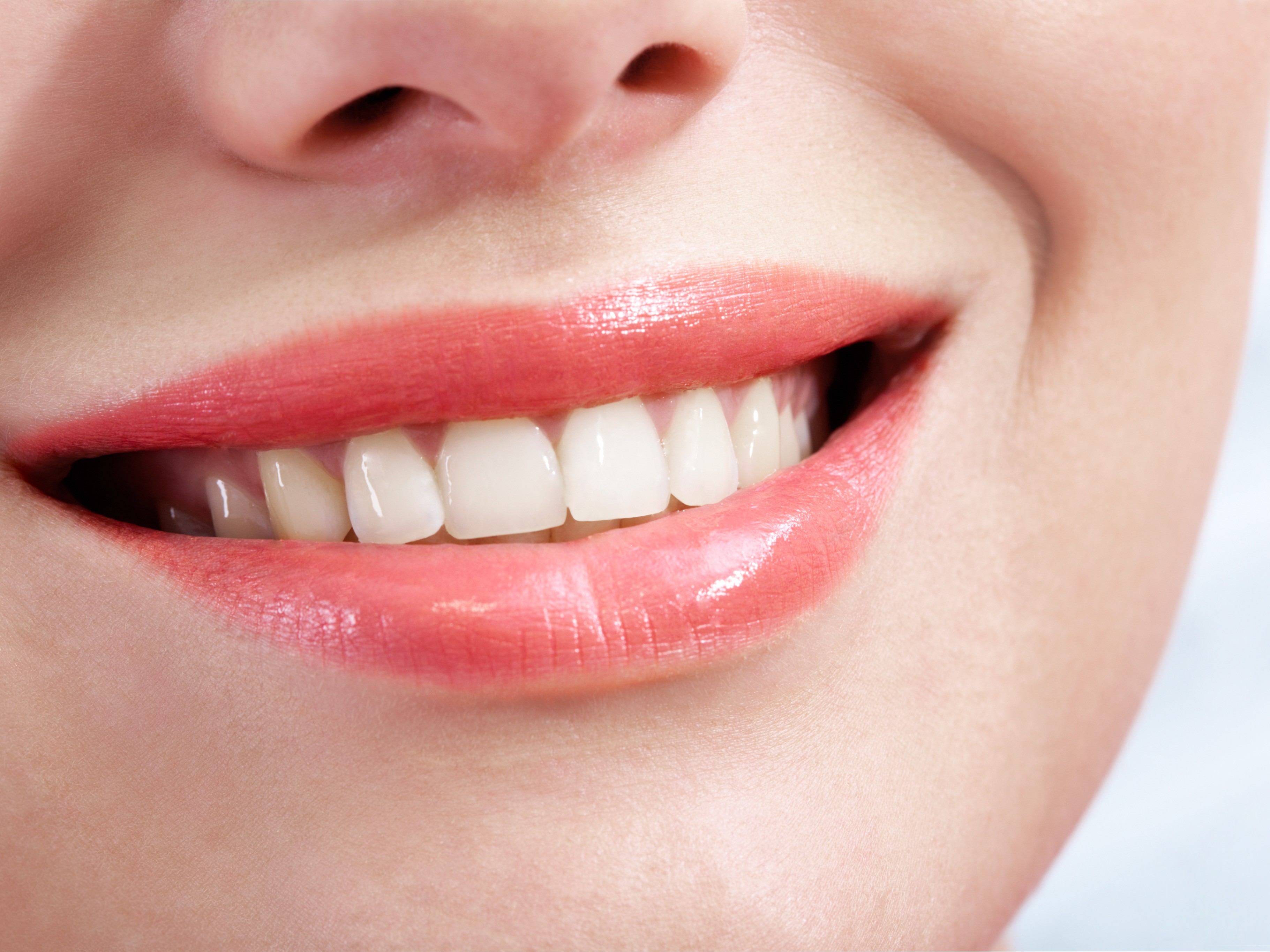 심미치주성형 이미지