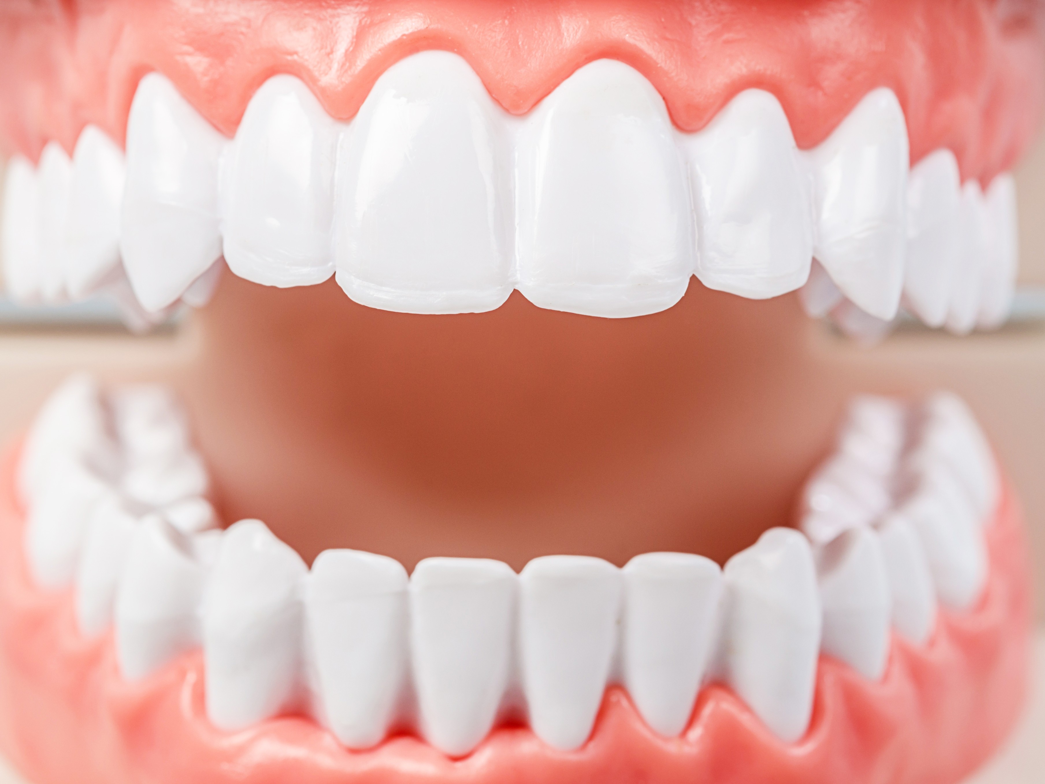 치아미백 이미지